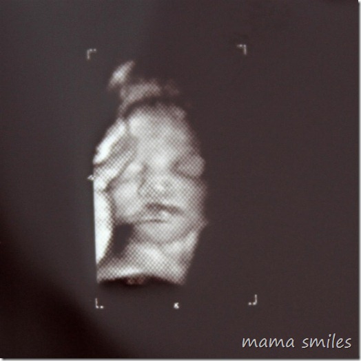 3D baby ultrasound
